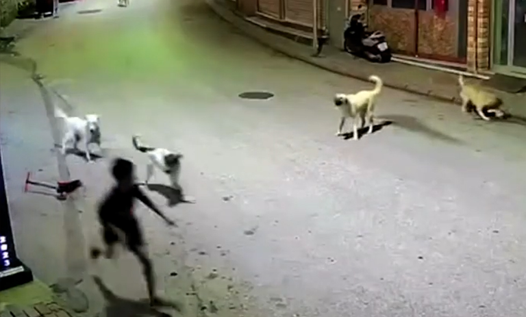 10 yaşındaki Ömer sahipsiz köpeklerin saldırısına uğradı!