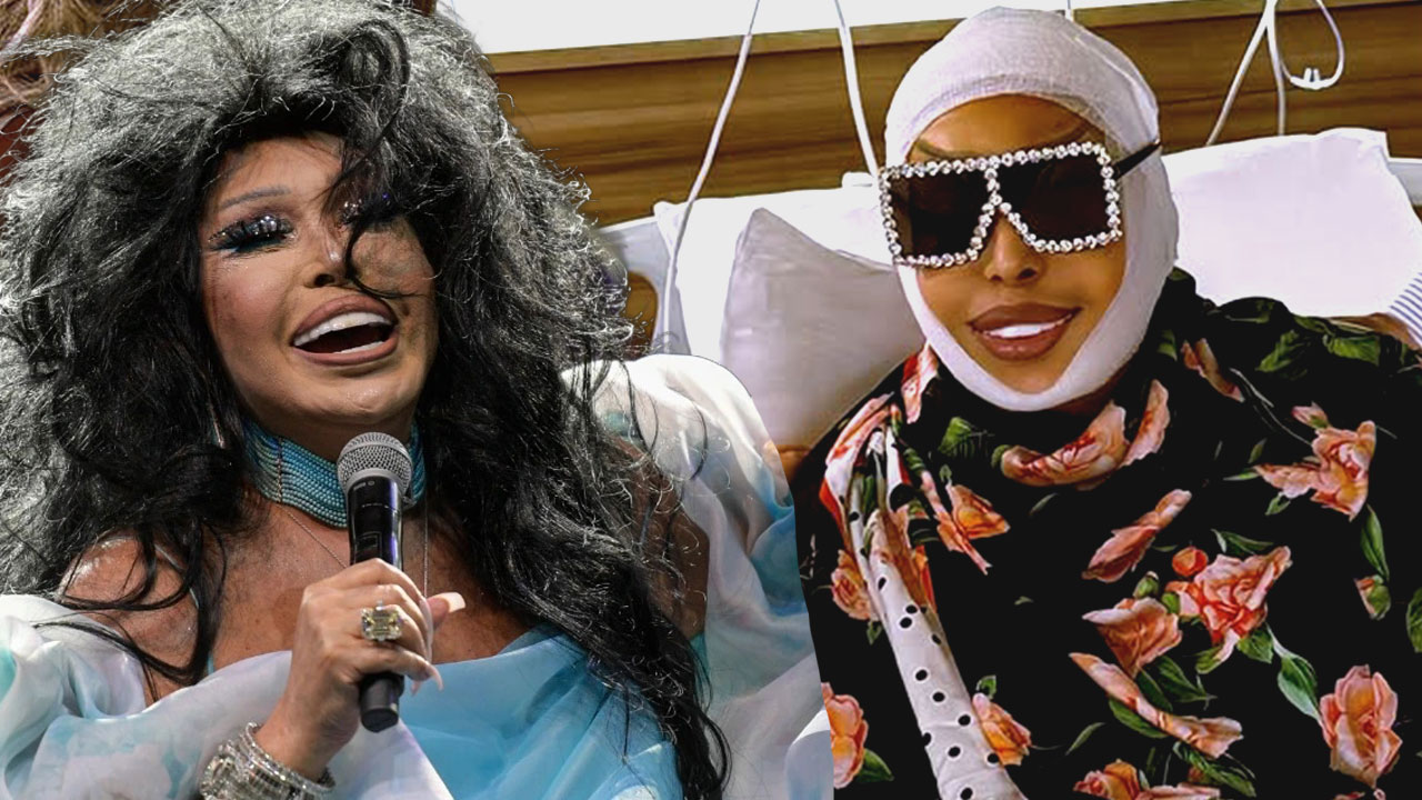 Bülent Ersoy estetik ameliyat oldu!